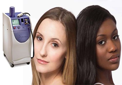 آیا دستگاه و فرکانس لیزر مو برای پوست های تیره با پوست های روشن متفاوت است؟
