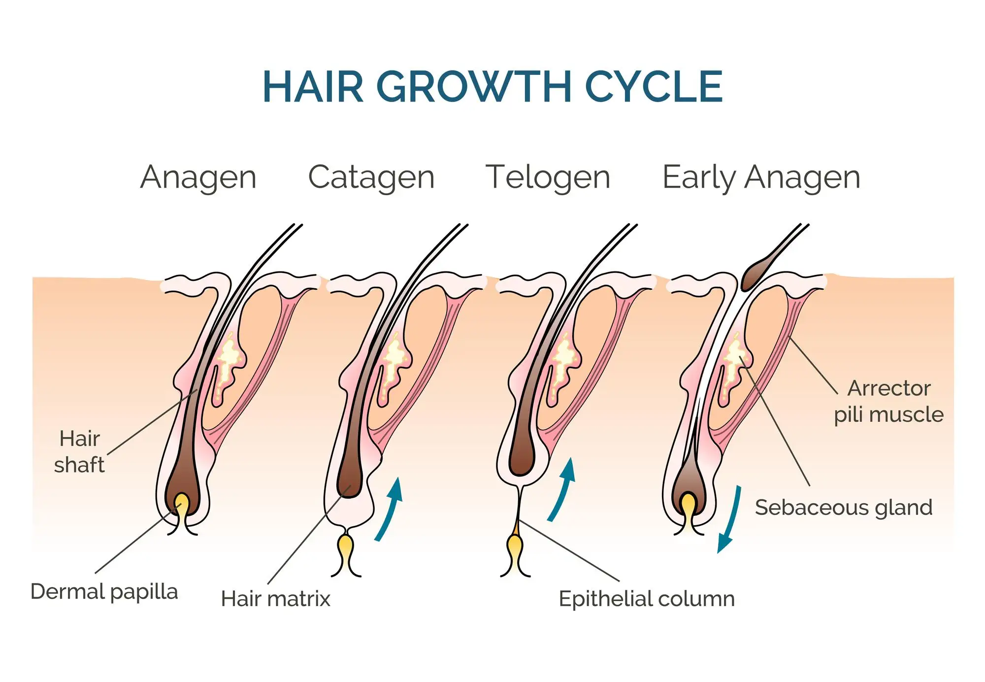 چرا بعد از لیزر موها دوباره رشد می کنند؟