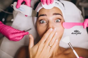 فیشیال بعد از بوتاکس