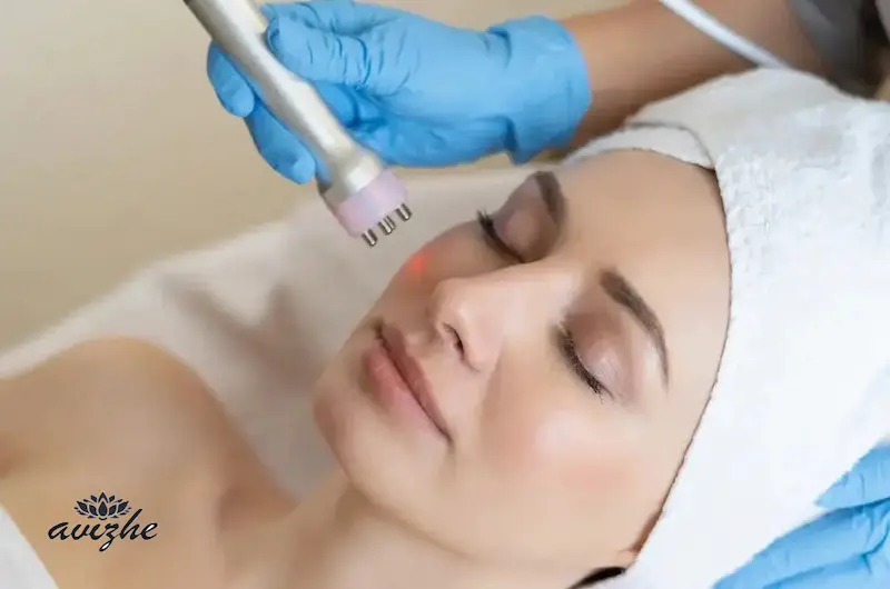 مراقبت‌های قبل و بعد از پلاژن‌تراپی