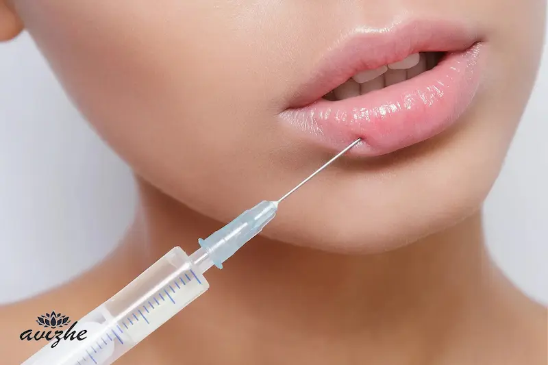 اگر بعد از تزریق ژل لب، مقداری از ژل جذب شده چه کاری باید انجام دهید؟