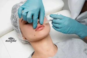 مراقبت های بعد از تزریق ژل لب