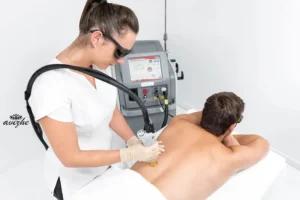 لیزر کندلا چند جلسه جواب میدهد؟