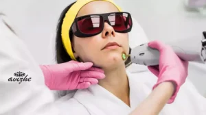 قیمت لیزر صورت زنان و مردان | هزینه لیزر موهای زائد